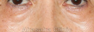 PreOP (1)_